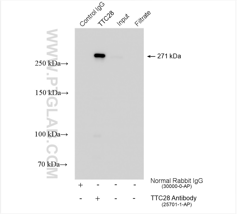 Immunoprecipitation (IP) experiment of HEK-293 cells using TTC28 Polyclonal antibody (25701-1-AP)