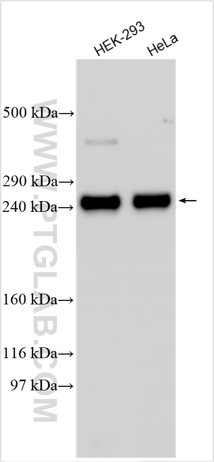 Western Blot (WB) analysis of various lysates using TTC28 Polyclonal antibody (25701-1-AP)