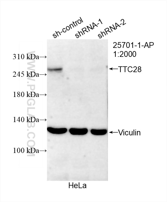 Western Blot (WB) analysis of HeLa cells using TTC28 Polyclonal antibody (25701-1-AP)