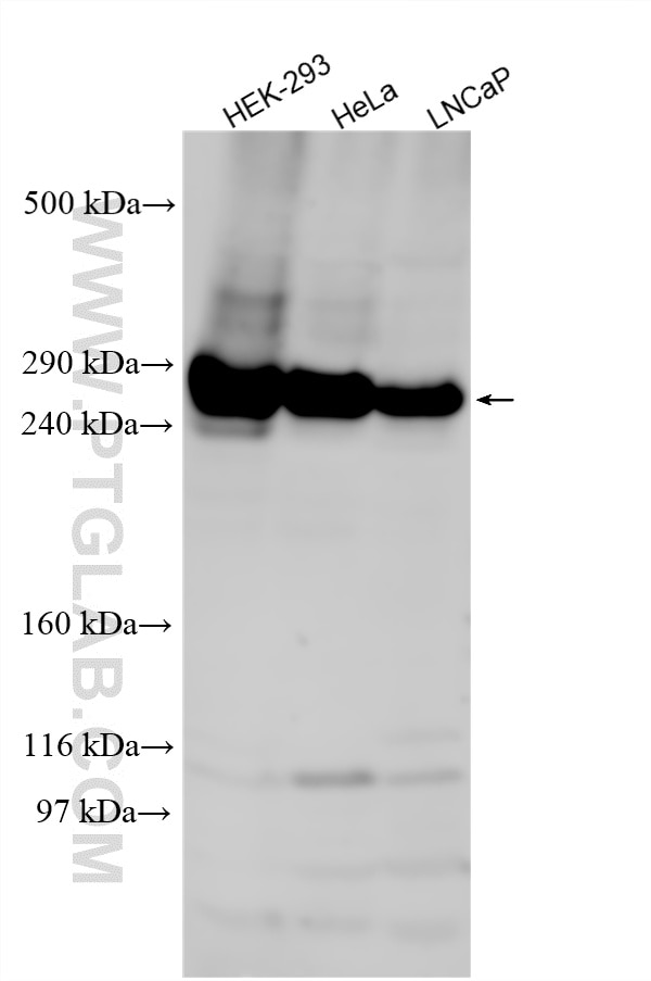 Western Blot (WB) analysis of various lysates using TTC28 Polyclonal antibody (25701-1-AP)
