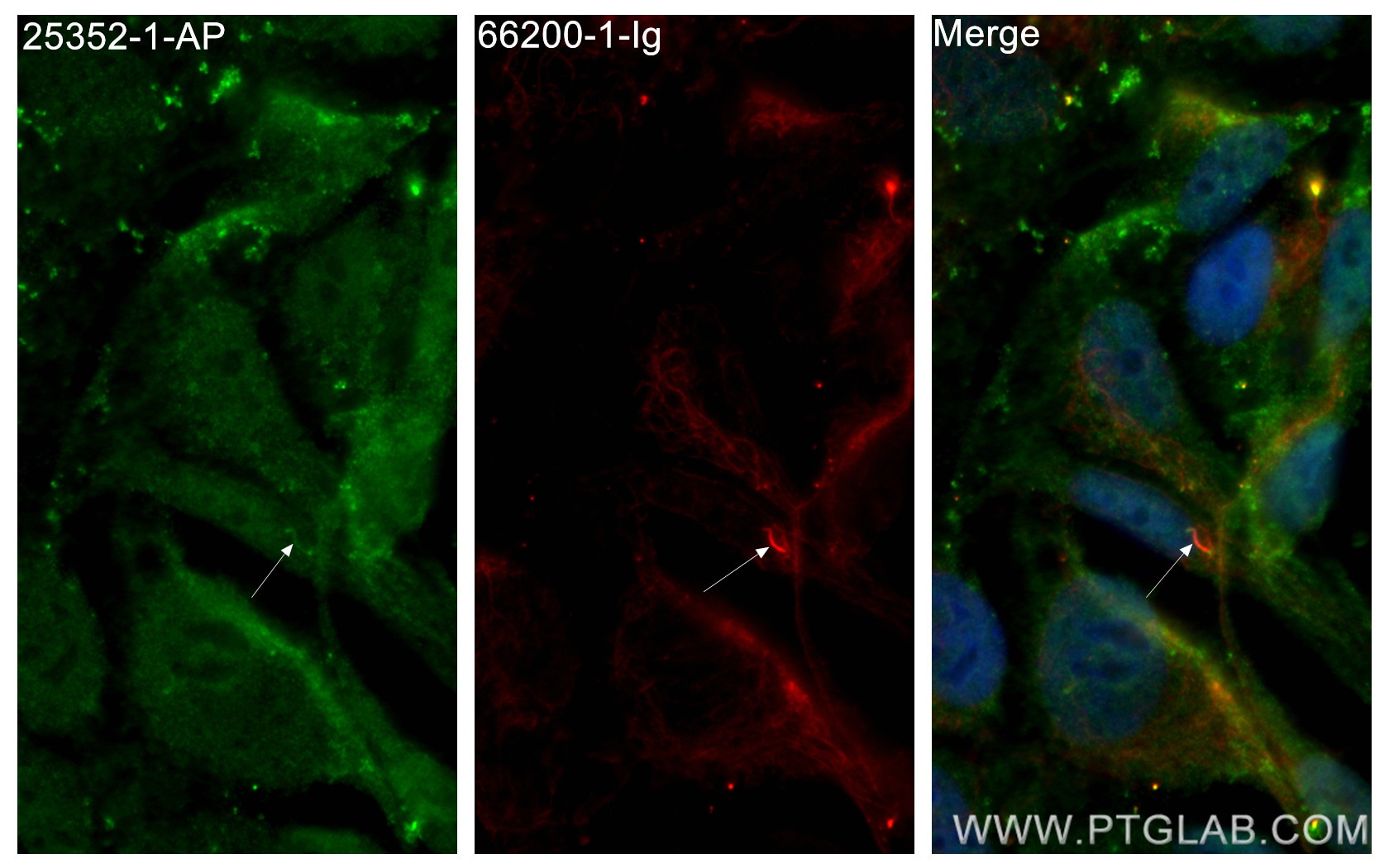 Immunofluorescence (IF) / fluorescent staining of hTERT-RPE1 cells using TTC30A Polyclonal antibody (25352-1-AP)