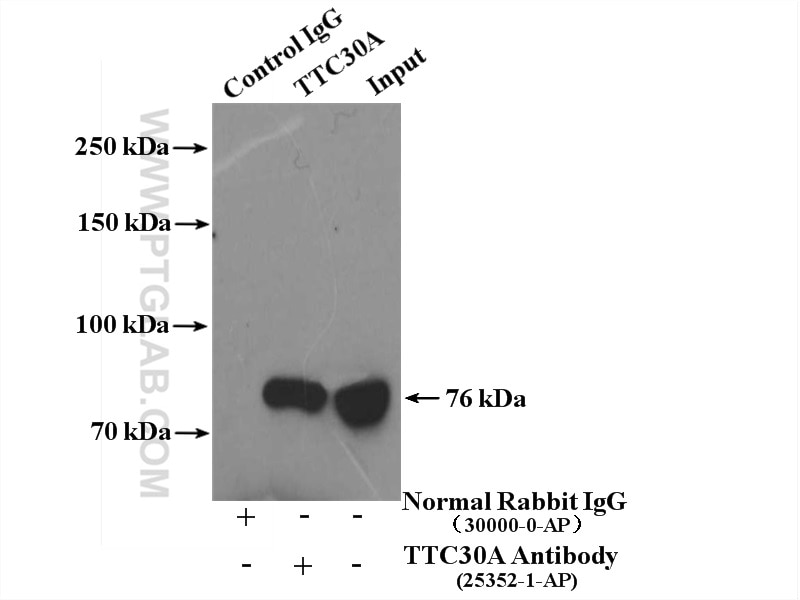 Immunoprecipitation (IP) experiment of HEK-293 cells using TTC30A Polyclonal antibody (25352-1-AP)