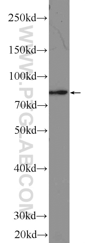 TTC30A