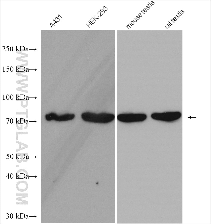 Western Blot (WB) analysis of various lysates using TTC30A Polyclonal antibody (25352-1-AP)