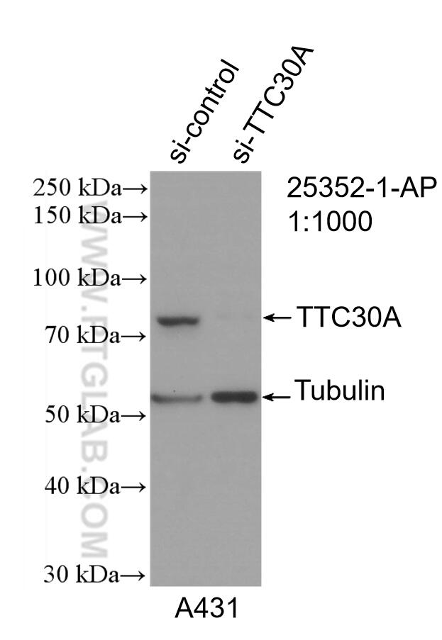 Western Blot (WB) analysis of A431 cells using TTC30A Polyclonal antibody (25352-1-AP)