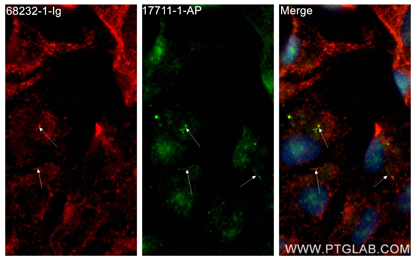 Immunofluorescence (IF) / fluorescent staining of hTERT-RPE1 cells using TTC30A Monoclonal antibody (68232-1-Ig)