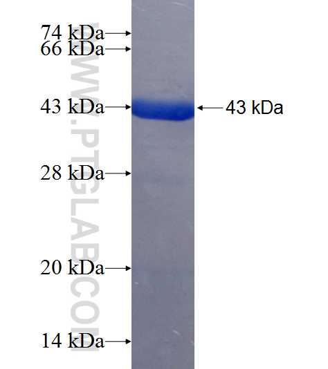 TTC30A fusion protein Ag18361 SDS-PAGE