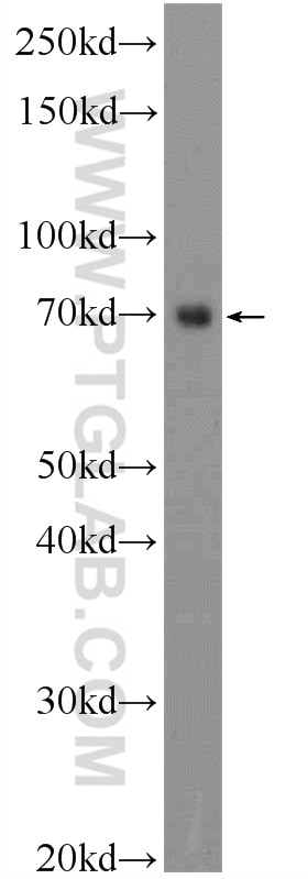 Western Blot (WB) analysis of mouse heart tissue using TTC30B Polyclonal antibody (21185-1-AP)