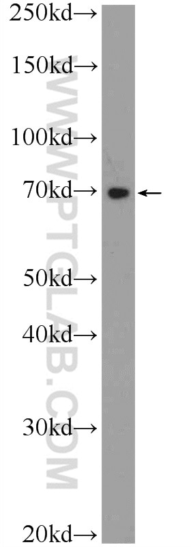 Western Blot (WB) analysis of HEK-293 cells using TTC30B Polyclonal antibody (21185-1-AP)