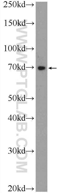 Western Blot (WB) analysis of HEK-293 cells using TTC30B Polyclonal antibody (21185-1-AP)