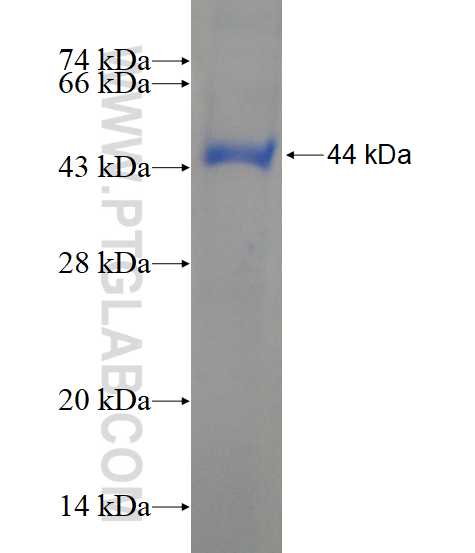 TTC30B fusion protein Ag15490 SDS-PAGE