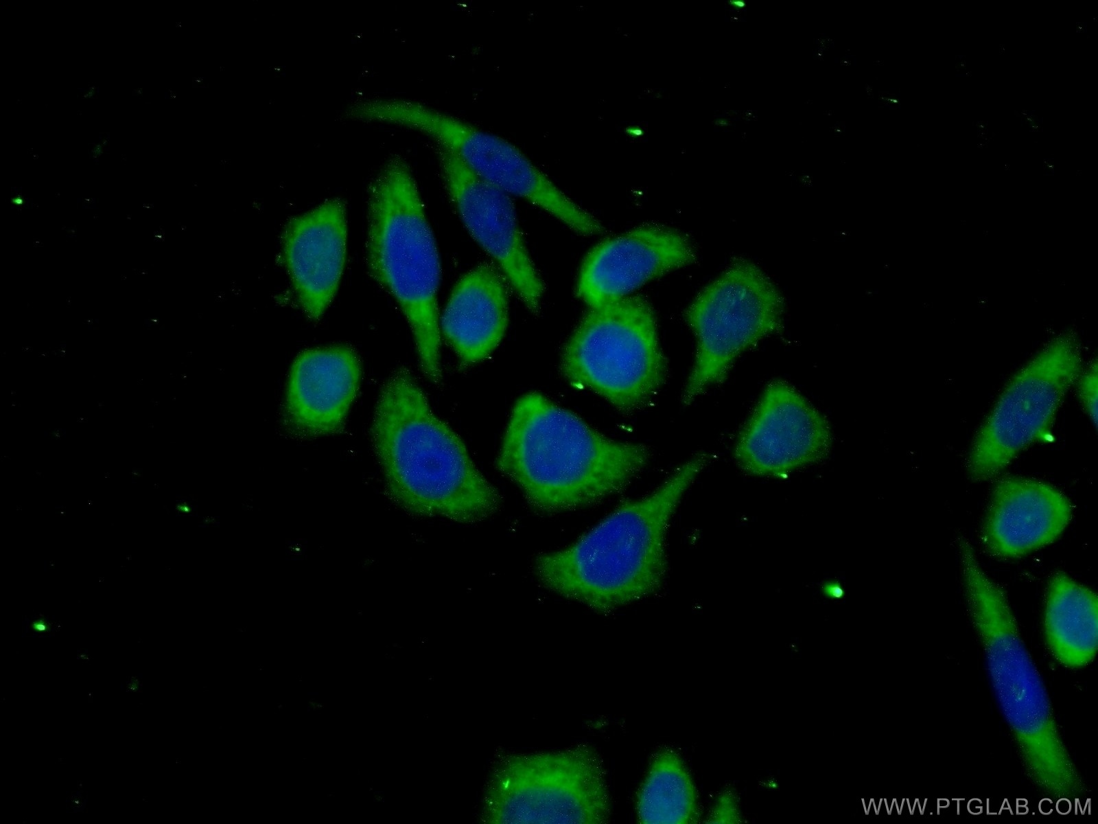 Immunofluorescence (IF) / fluorescent staining of PC-3 cells using TTC31 Polyclonal antibody (21693-1-AP)