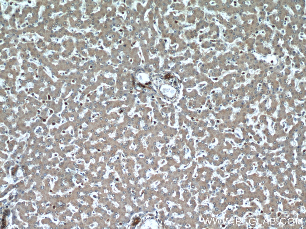 Immunohistochemistry (IHC) staining of human liver tissue using TTC31 Polyclonal antibody (21693-1-AP)