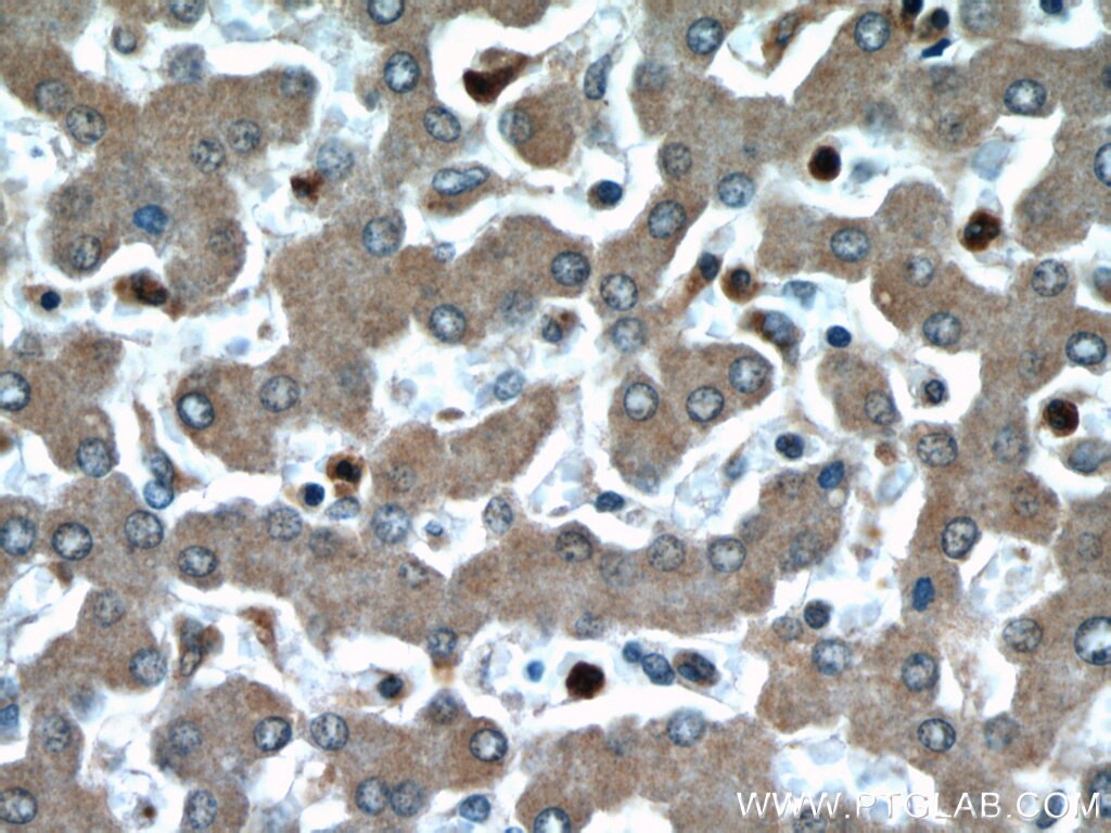 Immunohistochemistry (IHC) staining of human liver tissue using TTC31 Polyclonal antibody (21693-1-AP)