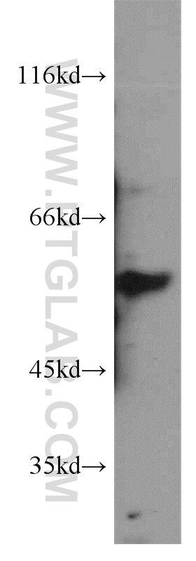 Western Blot (WB) analysis of PC-3 cells using TTC31 Polyclonal antibody (21693-1-AP)