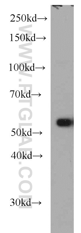 Western Blot (WB) analysis of PC-3 cells using TTC31 Polyclonal antibody (21693-1-AP)