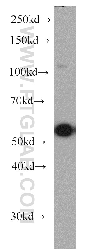 Western Blot (WB) analysis of PC-3 cells using TTC31 Polyclonal antibody (21693-1-AP)