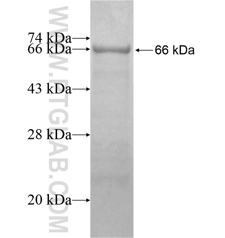 TTC31 fusion protein Ag16281 SDS-PAGE