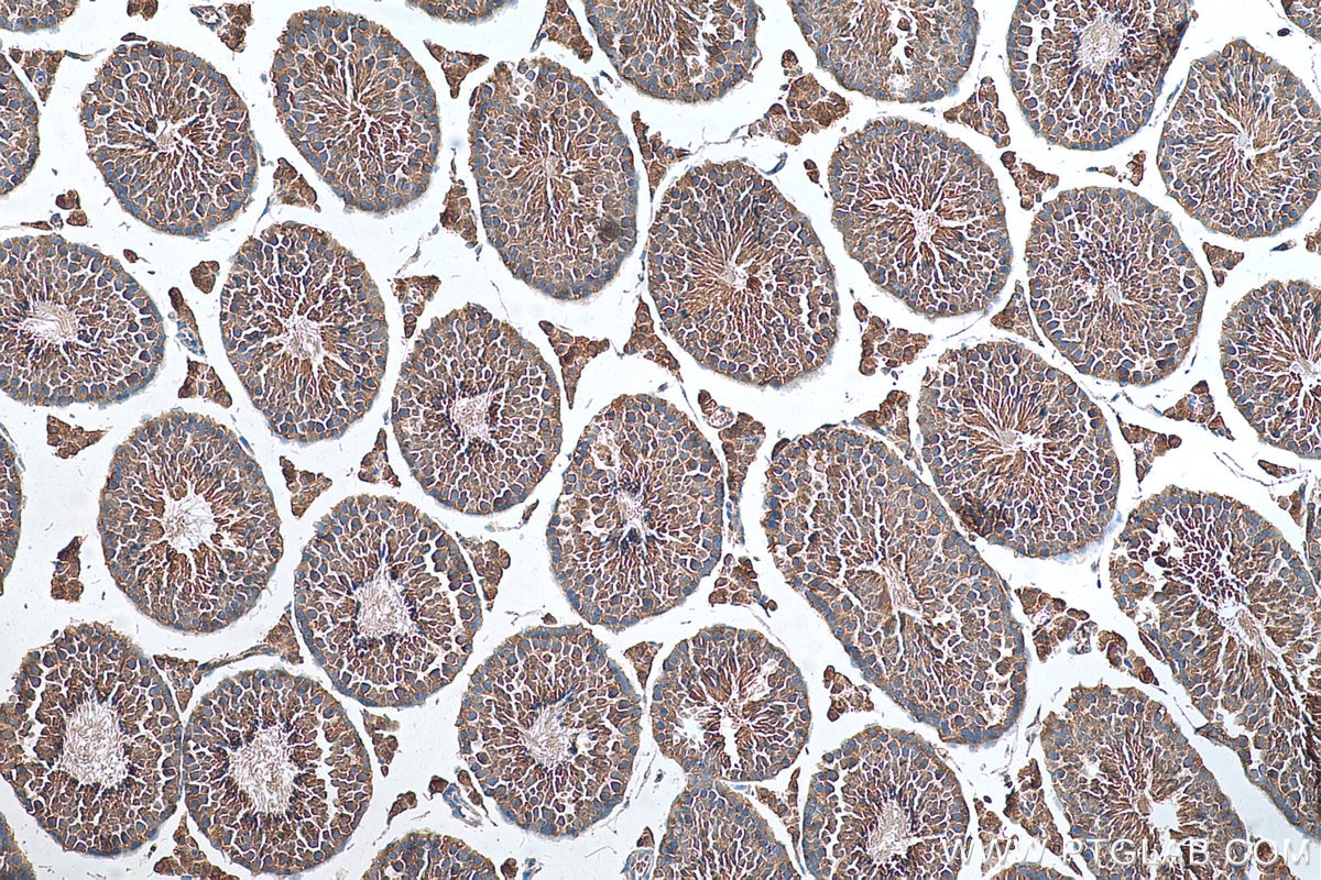 IHC staining of mouse testis using 25422-1-AP