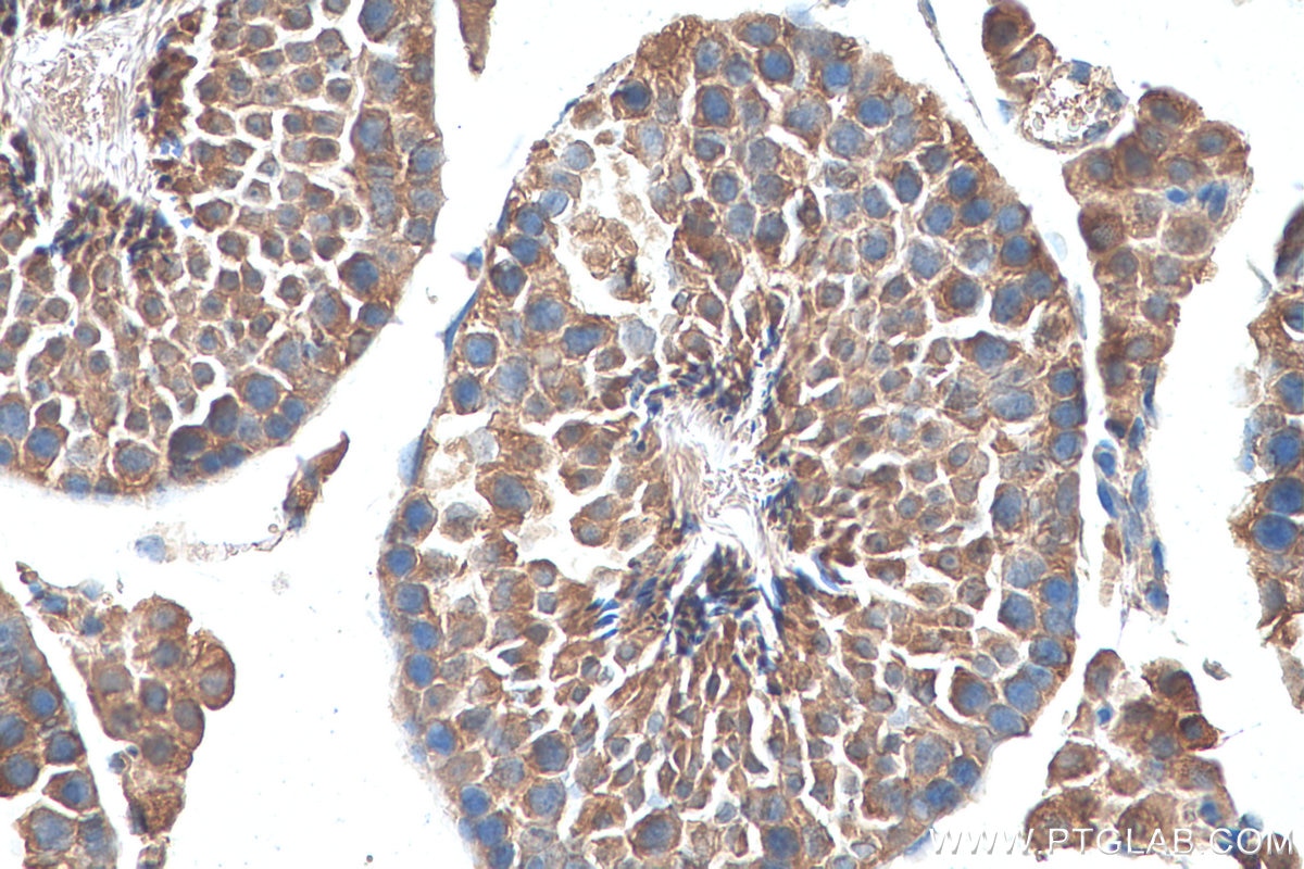 Immunohistochemistry (IHC) staining of mouse testis tissue using TTC32 Polyclonal antibody (25422-1-AP)