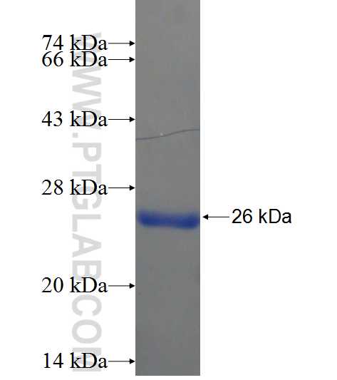 TTC32 fusion protein Ag22115 SDS-PAGE