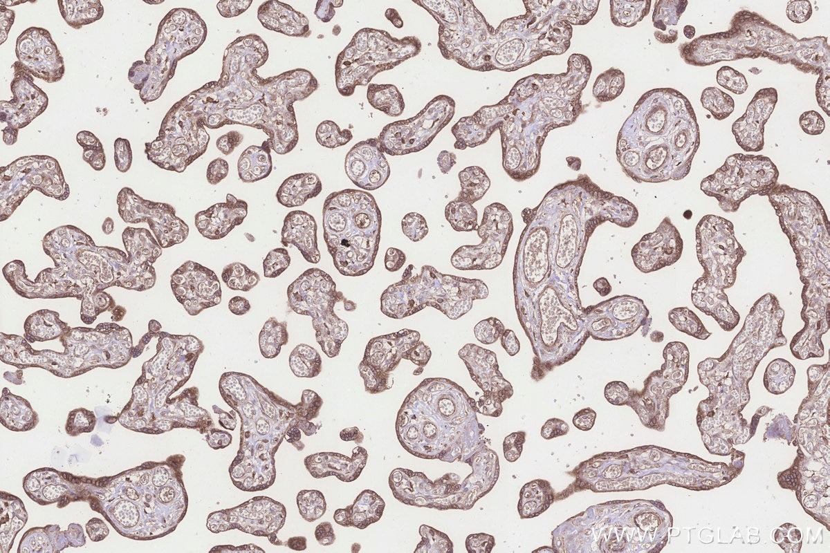 Immunohistochemistry (IHC) staining of human placenta tissue using TTC35 Polyclonal antibody (25443-1-AP)