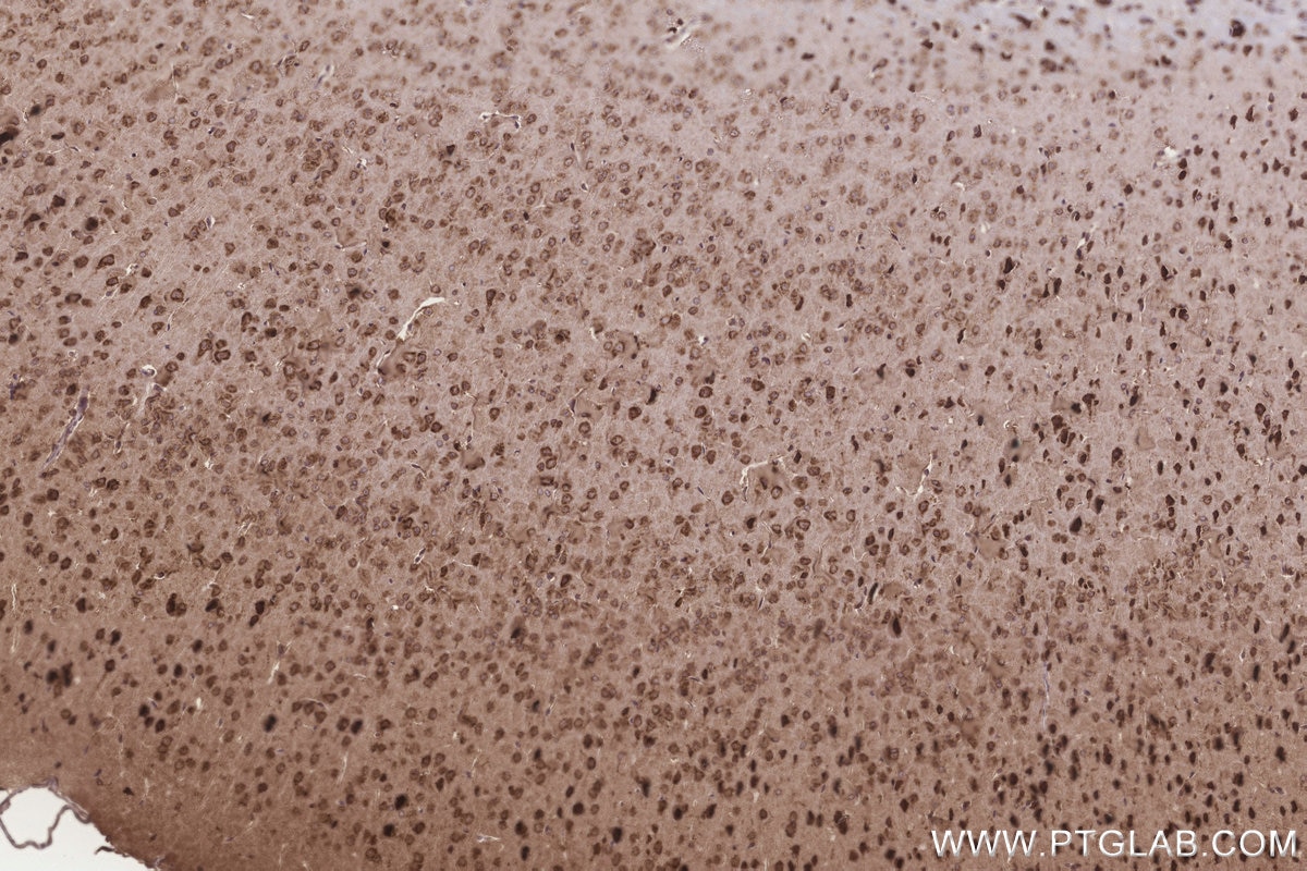 Immunohistochemistry (IHC) staining of mouse brain tissue using TTC35 Polyclonal antibody (25443-1-AP)