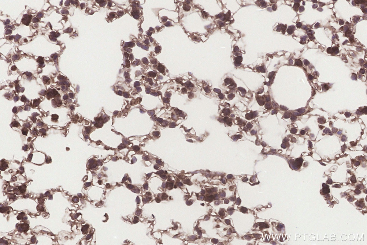 Immunohistochemistry (IHC) staining of mouse lung tissue using TTC35 Polyclonal antibody (25443-1-AP)