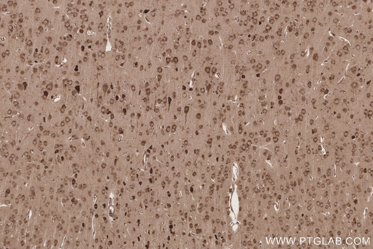 Immunohistochemistry (IHC) staining of rat brain tissue using TTC35 Polyclonal antibody (25443-1-AP)