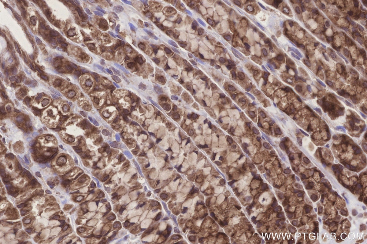 Immunohistochemistry (IHC) staining of rat stomach tissue using TTC35 Polyclonal antibody (25443-1-AP)