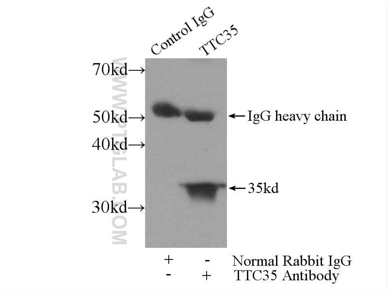 Immunoprecipitation (IP) experiment of mouse heart tissue using TTC35 Polyclonal antibody (25443-1-AP)