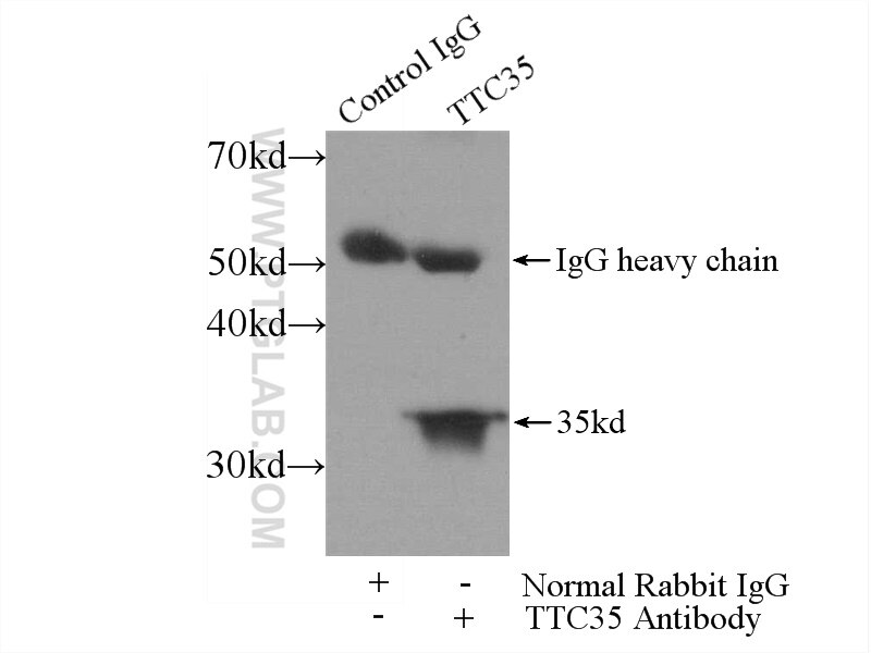 IP experiment of mouse heart using 25443-1-AP