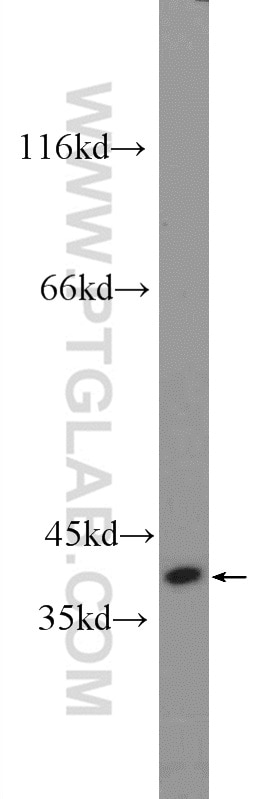 WB analysis of mouse heart using 25443-1-AP