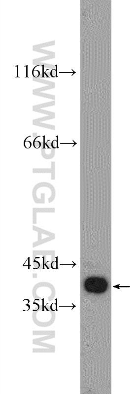 WB analysis of K-562 using 25443-1-AP