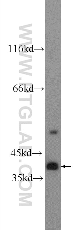 Western Blot (WB) analysis of MCF-7 cells using TTC35 Polyclonal antibody (25443-1-AP)