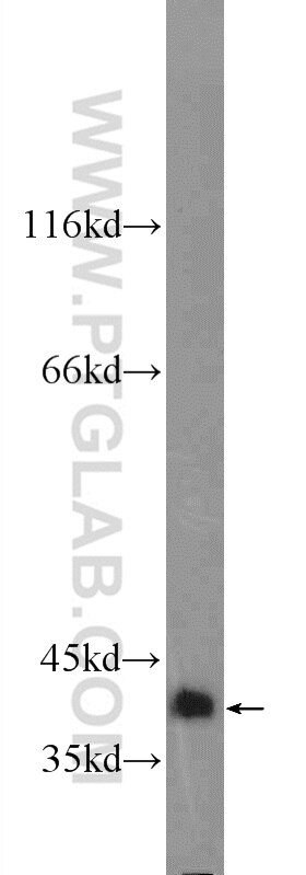 Western Blot (WB) analysis of mouse spleen tissue using TTC35 Polyclonal antibody (25443-1-AP)