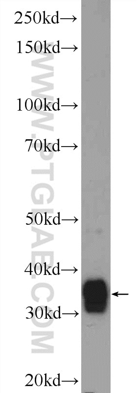 Western Blot (WB) analysis of Jurkat cells using TTC35 Polyclonal antibody (25443-1-AP)