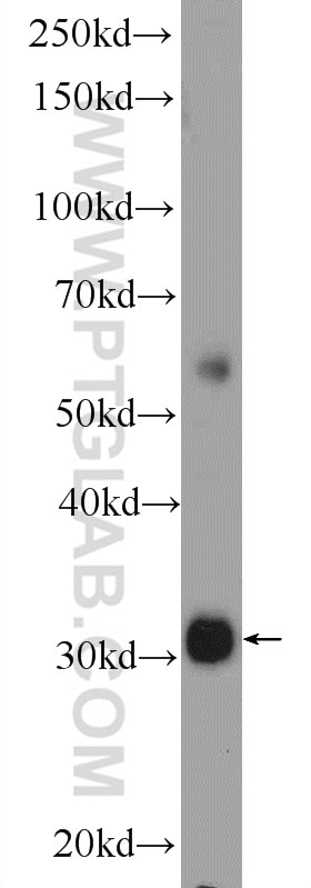 Western Blot (WB) analysis of human placenta tissue using TTC35 Polyclonal antibody (25443-1-AP)