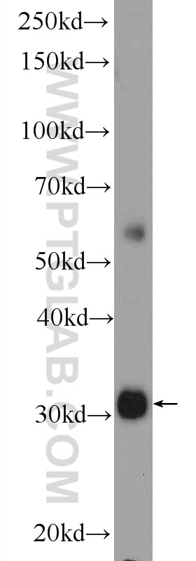 WB analysis of human placenta using 25443-1-AP