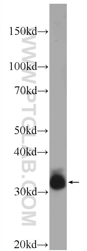 WB analysis of SKOV-3 using 25443-1-AP