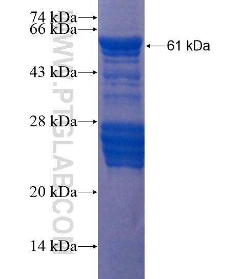 TTC35 fusion protein Ag22196 SDS-PAGE