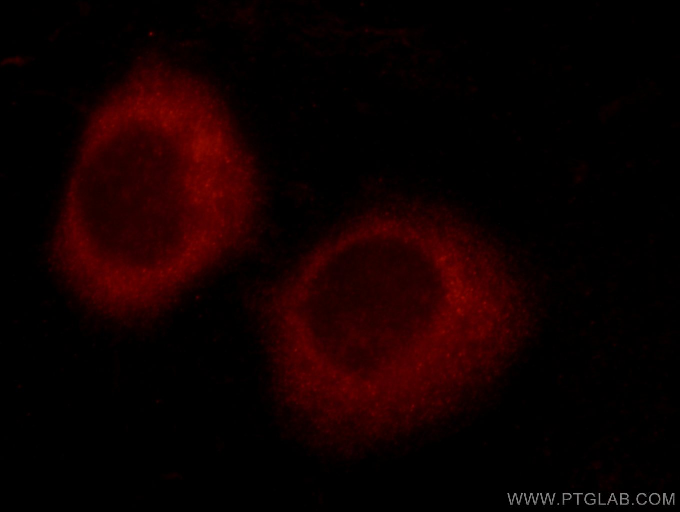 Immunofluorescence (IF) / fluorescent staining of HepG2 cells using TTC37 Polyclonal antibody (24594-1-AP)