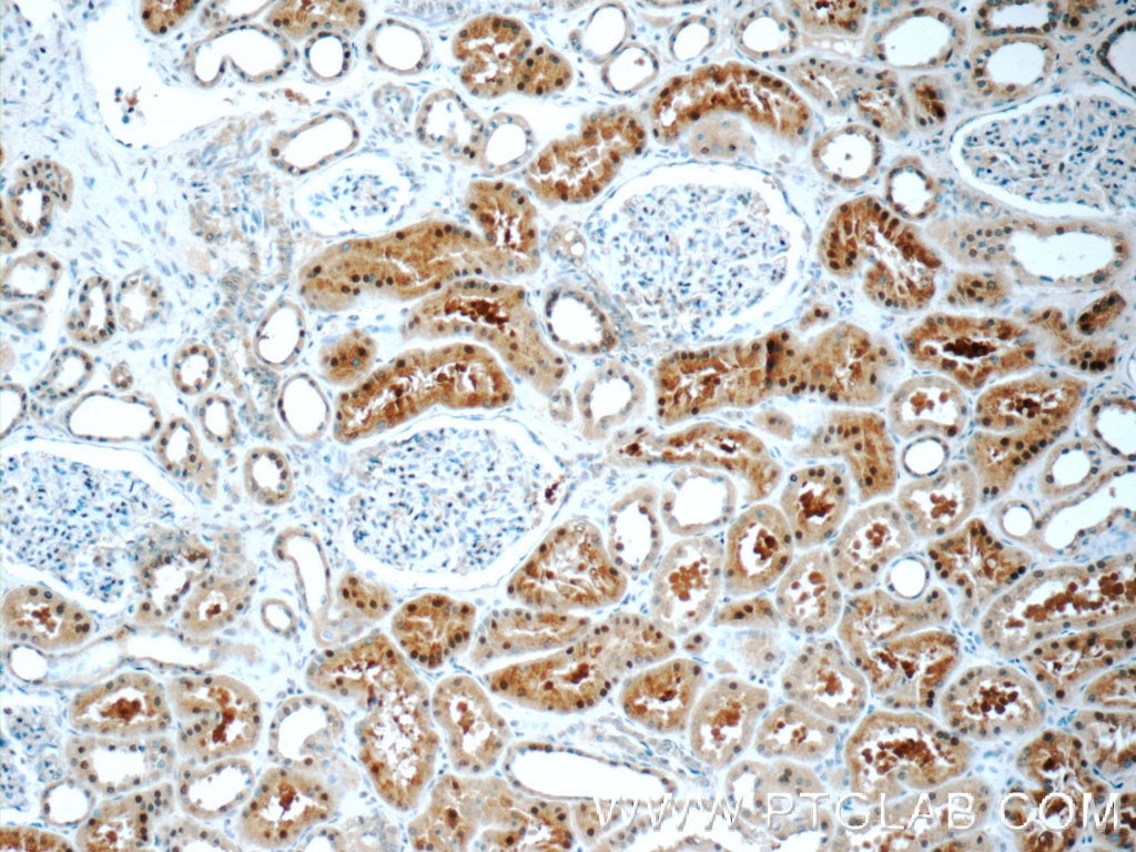 Immunohistochemistry (IHC) staining of human kidney tissue using TTC37 Polyclonal antibody (24594-1-AP)