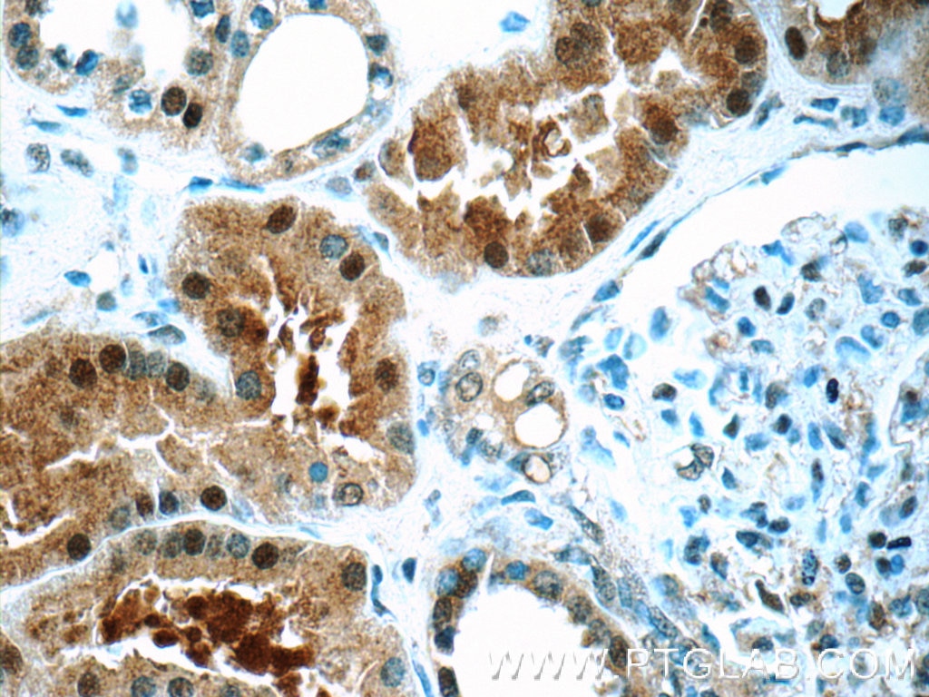 Immunohistochemistry (IHC) staining of human kidney tissue using TTC37 Polyclonal antibody (24594-1-AP)