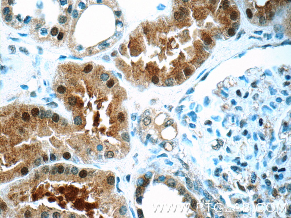 IHC staining of human kidney using 24594-1-AP