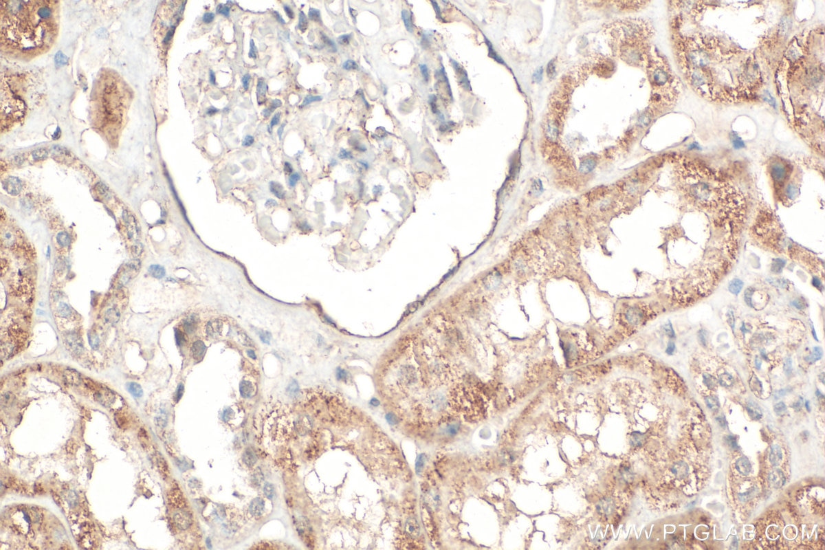 Immunohistochemical analysis of paraffin-embedded human kidney tissue slide using 24594-1-AP (TTC37 antibody) at dilution of 1:400 (under 40x lens). Heat mediated antigen retrieval with Tris-EDTA buffer (pH 9.0). Immunohistochemistry (IHC) staining of human kidney tissue using TTC37 Polyclonal antibody (24594-1-AP)