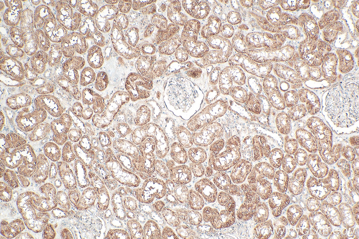 Immunohistochemical analysis of paraffin-embedded human kidney tissue slide using 24594-1-AP (TTC37 antibody) at dilution of 1:400 (under 10x lens). Heat mediated antigen retrieval with Tris-EDTA buffer (pH 9.0). Immunohistochemistry (IHC) staining of human kidney tissue using TTC37 Polyclonal antibody (24594-1-AP)