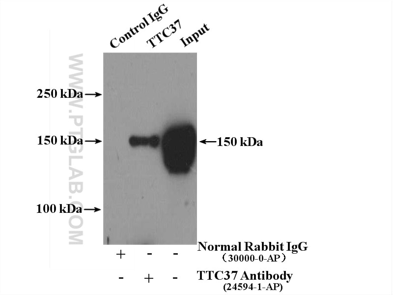 Immunoprecipitation (IP) experiment of mouse testis tissue using TTC37 Polyclonal antibody (24594-1-AP)