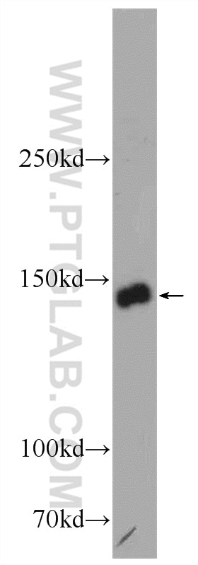 Western Blot (WB) analysis of MCF-7 cells using TTC37 Polyclonal antibody (24594-1-AP)
