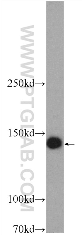 Western Blot (WB) analysis of HeLa cells using TTC37 Polyclonal antibody (24594-1-AP)